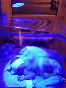 wat is geelzucht bij baby's
